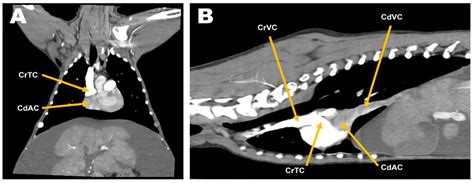 Partial Venous Inflow Occlusion Under Mild Hypothermia For