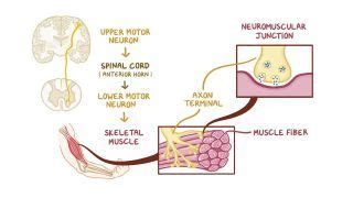 muscle spasms     diagnosis   osmosis