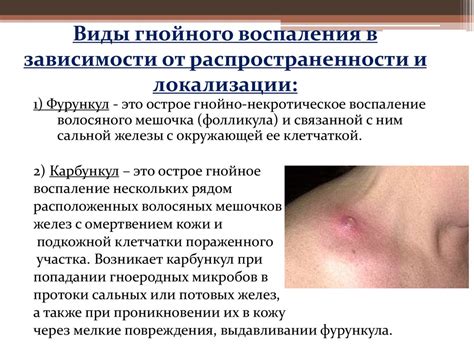 Воспаление - online presentation