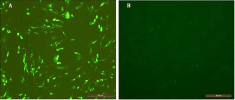 Indirect Immunofluorescence Assay Ifa Emcv C15 Infected Bhk21 Cells