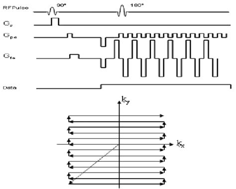 The Epi Pulse Sequence Above And Epi Kspace Coverage Below