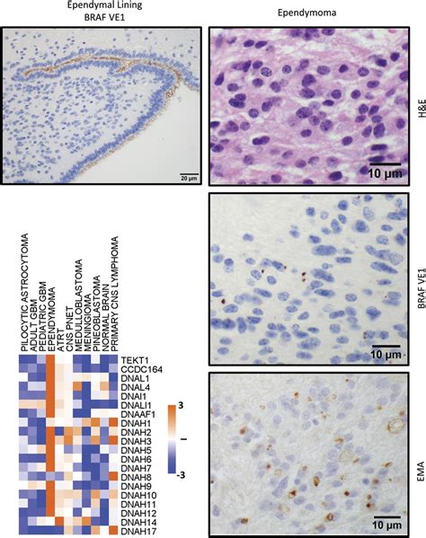 Expression Of Axonemal Proteins In The Cilia Of Ependymal Lining And In