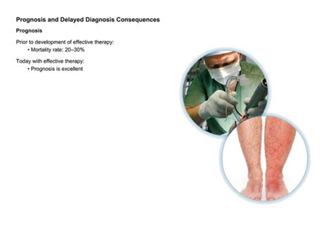 Hereditary_Angioedema_Diagnosis