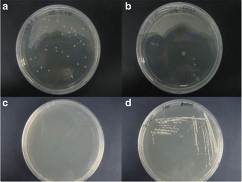 Colony of S. epidermidis after 24 h of incubation at 37 °C. a Before ...