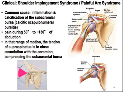 Scapular Region Clinical Flashcards Quizlet