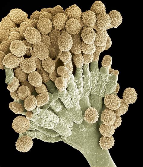 Aspergillus Fungus Sem Photograph By Steve Gschmeissner Fine Art America