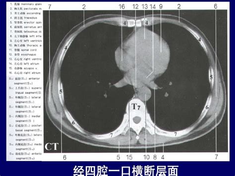 人体断层解剖学 纵隔的断层解剖word文档在线阅读与下载无忧文档