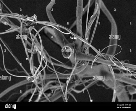 Spider silk microscope hi-res stock photography and images - Alamy