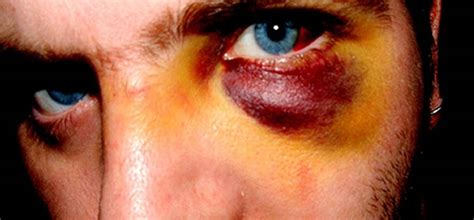 Noviazgos violentos en parejas gay un drama secreto que empieza a salir del clóset Infobae
