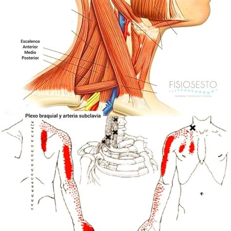 M Sculos De La Regi N Posterior Del Cuello En El Plano Medio Entre No