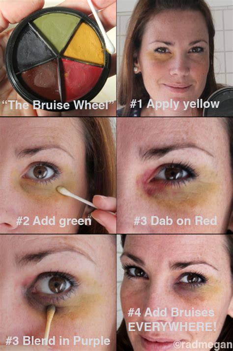 How To Give Yourself A Bruise