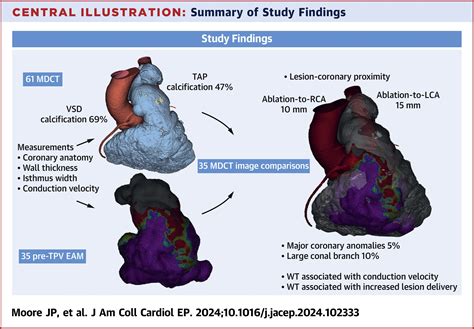 Multidetector Computed Tomography Assessment Of Anatomical Ventricular