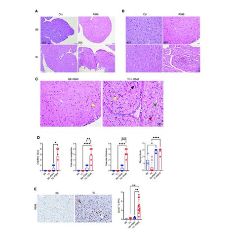 TLR7 Activation Induces Cardiovascular Pathology In TC Mice