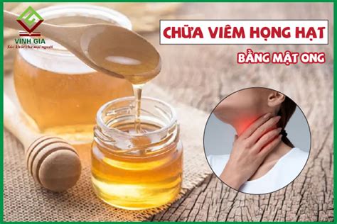 Cách Chữa Viêm Họng Hạt Bằng Mật Ong Phương Pháp Tự Nhiên Hiệu Quả