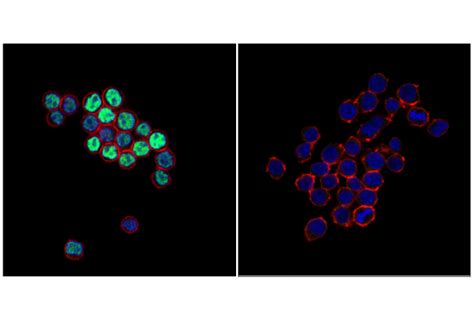 Pax D H X Xp Rabbit Mab Bsa And Azide Free Cell Signaling