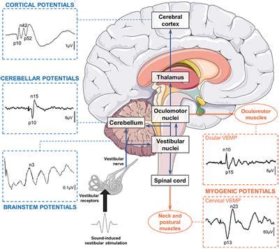 Frontiers Vestibular Evoked Cerebral Potentials