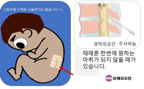 임신 37주 무통 분만 포해피우먼닷컴