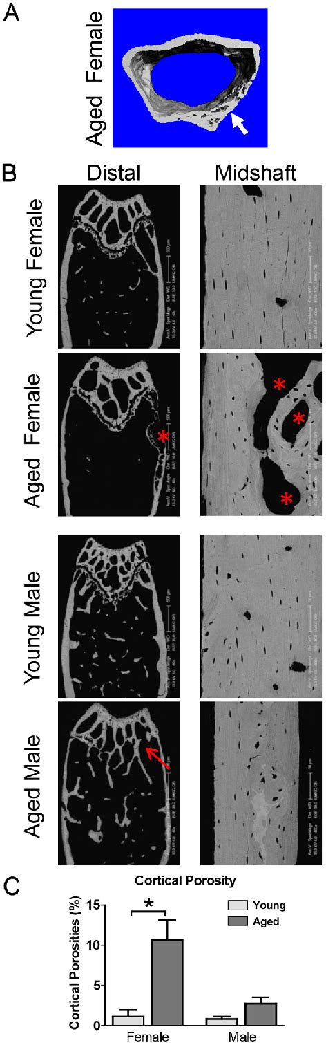 Figure From Degeneration Of The Osteocyte Network In The C Bl