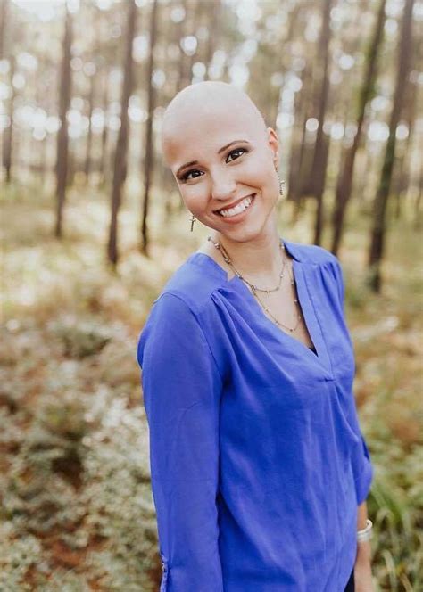 Woman shares complete alopecia in beautiful engagement photoshoot ...