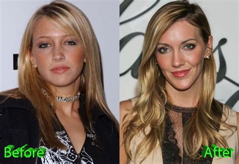 Katie Cassidy Plastic Surgery: Not The Best Of Ideas