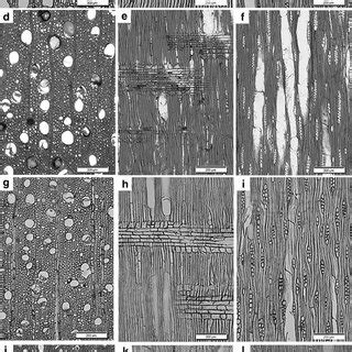 Wood Anatomical Features Of Santalum A B And C Transverse Radial