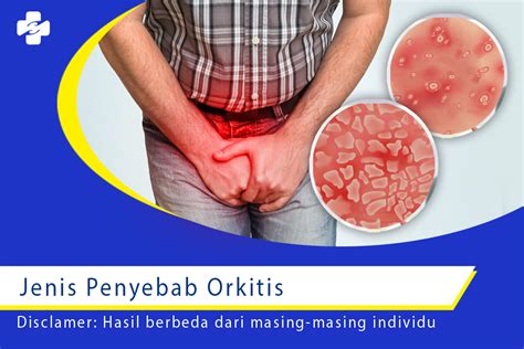 Waspadai Jenis Penyebab Orkitis Pada Pria Klinik Utama Sentosa