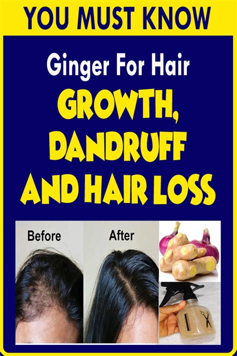 Ginger For Hair Growth Dandruff And Hair Loss