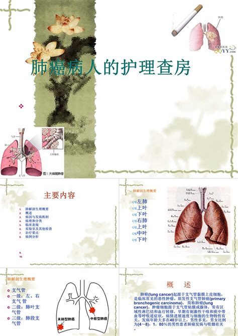 肺癌患者护理查房ppt卡卡办公