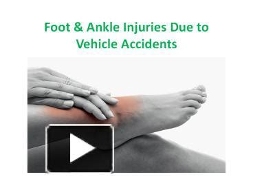 PPT Foot Ankle Injuries Due To Vehicle Accidents PowerPoint