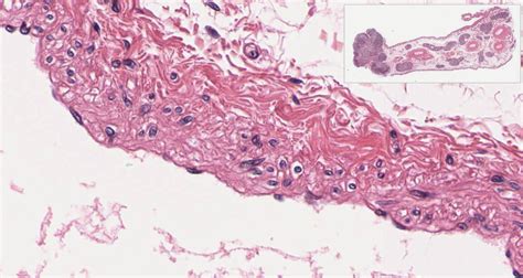 Simple Squamous Epithelial Tissue Under Microscope