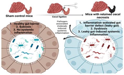 Ijms Free Full Text Lacticaseibacillus Rhamnosus Dfa1 Attenuate Cecal Ligation Induced