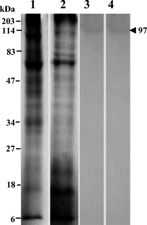 Coomassie Stained Sds Page And Immunoblotting Of Trianthema