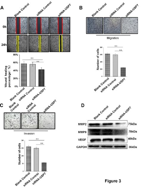 Usp7 Knockdown Suppresses Migration And Invasion Of Oscc Cells In