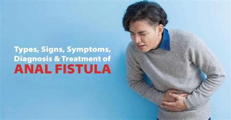 Types Signs Symptoms Diagnosis Treatment Of Anal Fistula