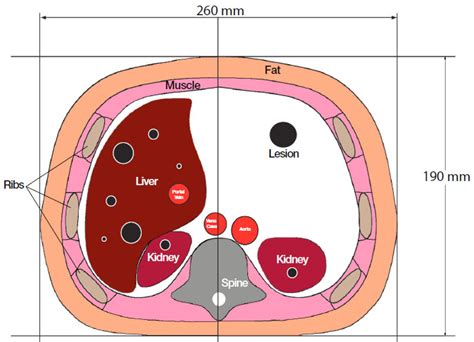 Triple Modality D Abdominal Phantom Cirs A Ct Ultrasound