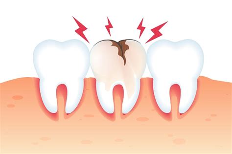 Principais Causas Da Dor De Dente Primavida Dental