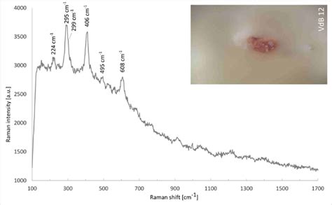 Micro Raman Spectra Of Sample Vdb Displaying The Characteristic