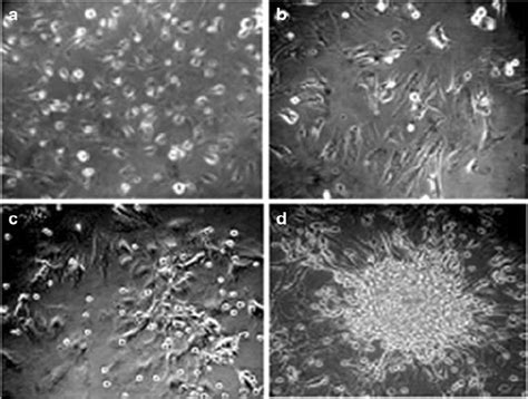 Osteoblast Formation Of MC3T3 E1 Subclon 14 Cells Cells Were Cultured