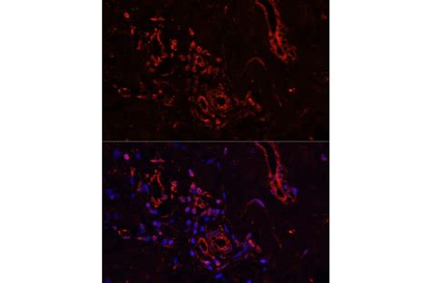 Anti-Collagen I Antibody (A11439) | Antibodies.com