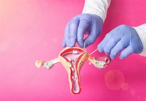 What are Tubectomy and Tubectomy Reversal - Dr. Mona Dahiya