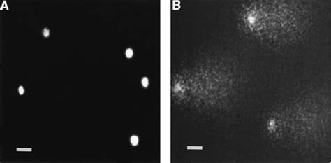 Sperm Cells Processed Using The Single Cell Gel Electrophoresis Comet