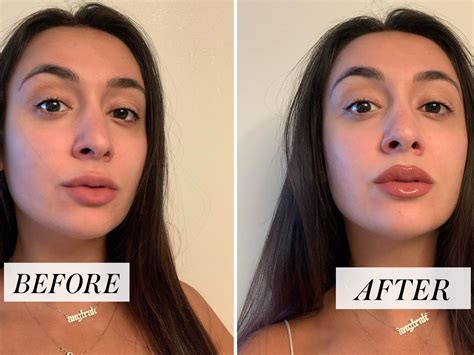 How To Make Your Top Lip Look Bigger Without Makeup | Makeupview.co