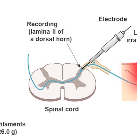 Schematic Diagram Of The In Vivo Extracellular Recording Setup Download Scientific Diagram