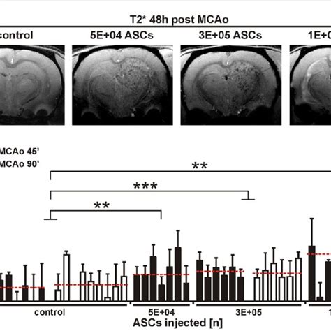 MRI Analysis Of Infarct Size 48 H Post MCAo A Representative