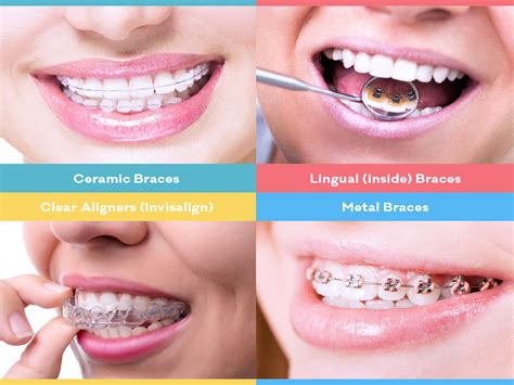 Orthodontic Treatment Options Straighten Teeth And Correct Jaws