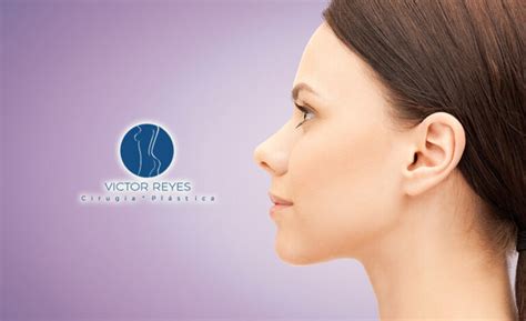 Diferencias Y Ventajas Entre Rinoplastia Cerrada Y Abierta