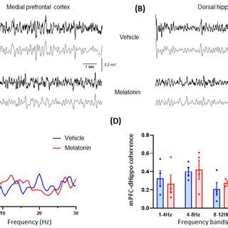 Medial Prefrontal Cortex MPFC Dorsal Hippocampus DHippo Synchrony