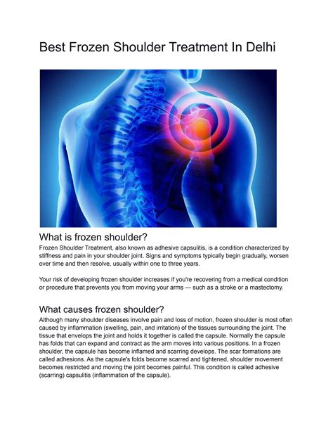 Best Frozen Shoulder Treatment In Delhi by tanu verma - Issuu