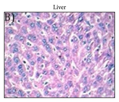 Hematoxylin And Eosin Hande Stained Photo Micrographs Of Mice Heart Download Scientific