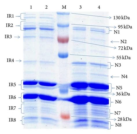 Coomassie Blue Stained Sds Page Showing Outer Membrane Protein Profile Download Scientific